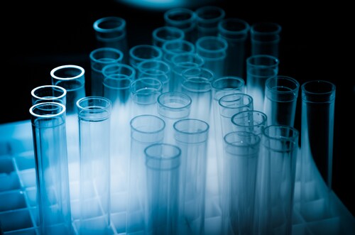 Test tubes on a dark background. Image: Pan Xunbin/Shutterstock.com