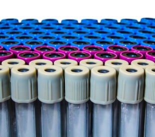 Blood specimen tubes on white background.
