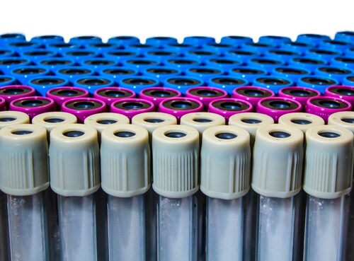 Blood specimen tubes on white background.
