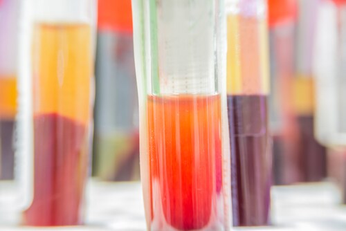 Test tubes with separated serum and blood. Image: Pongsak A/Shutterstock.com