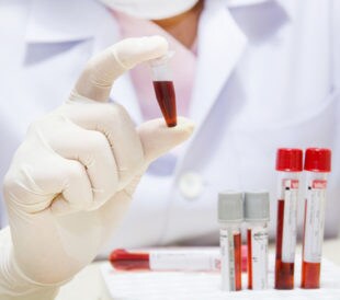 Scientist holding a biosample. Image: Blind Turtle/Shutterstock.com