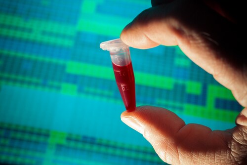 Test tube with genetic results in the background. Image: science photo/Shutterstock.com