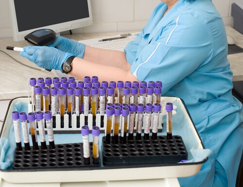 Nurse feeds data of test tubes with blood for analysis into the database. Image: withGod/Shutterstock.com.