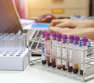 Scientist works on the blood inspection results. Image: Photostriker/Shutterstock.com.