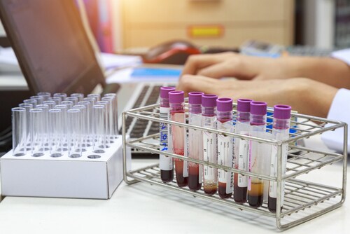 Scientist works on the blood inspection results. Image: Photostriker/Shutterstock.com.