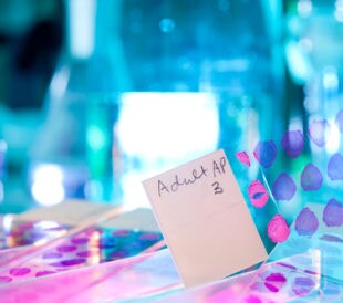 Slide glass with histological sections for microscopy. Image: anyaivanova/Shutterstock.com.