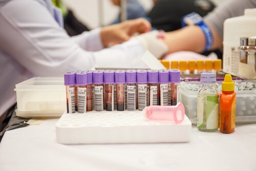 Laboratory with nurse taking a blood sample from patient, in background samples blood. Image: WathanyuSowong/Shutterstock.com.