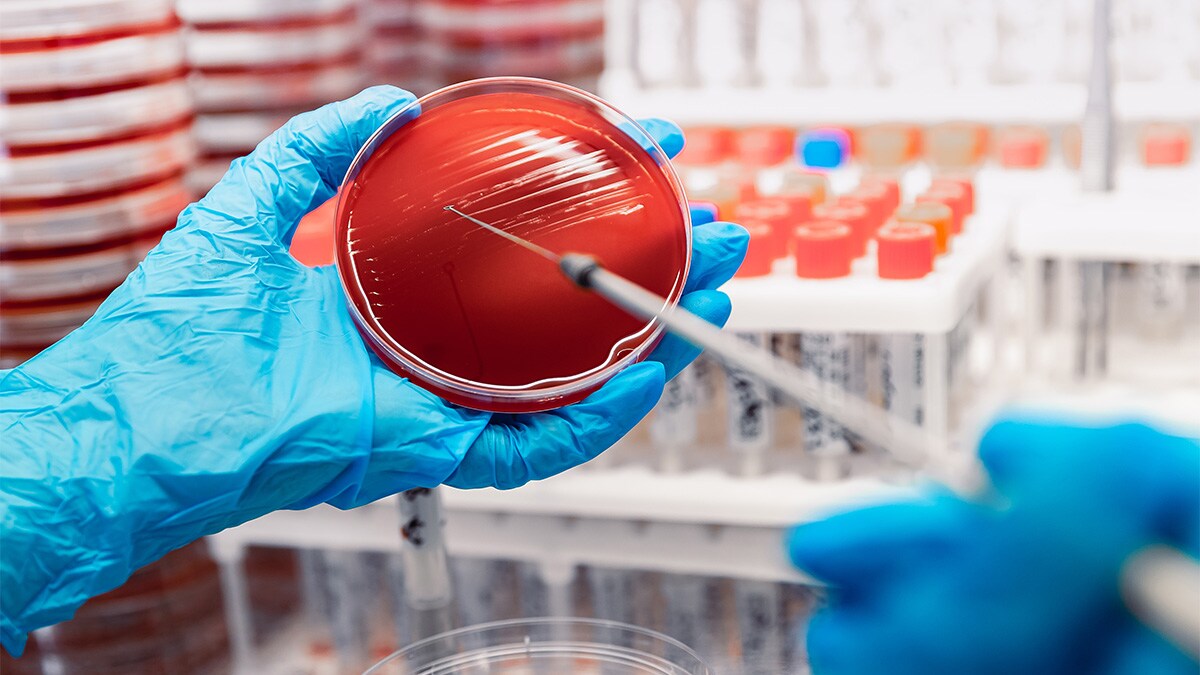 Microbial culture is traditionally the gold standard for the detection of many infectious pathogens. Molecular diagnostics can detect organisms missed by routine culture.