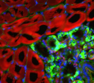 Immunofluorescence-of-pork-tongue-title