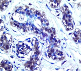 Immunohistochemistry-title