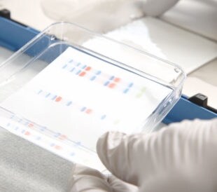 enhancing-western-blot-signals-title