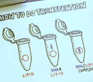 guidelines-and-optimizing-for-plasmid-dna-transfection-title