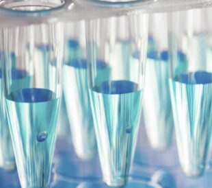 BCA法、Bradford法、Lowry法など、“総”タンパク質定量法の原理まとめ｜知っておきたい！タンパク質実験あれこれ 第4回