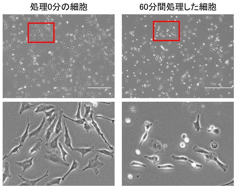 やってみた】細胞をTrypsinで処理しすぎてみた - Learning at the Bench