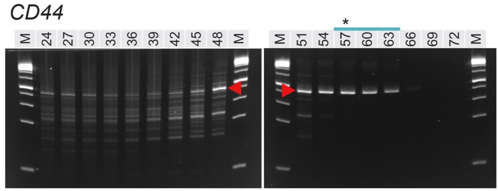 CD44結果