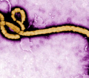 Ebola