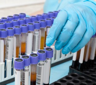 Biobanking