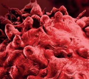 Cancer Research Foundation – Meet The Winners