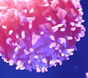 Molecular profiling of tumors