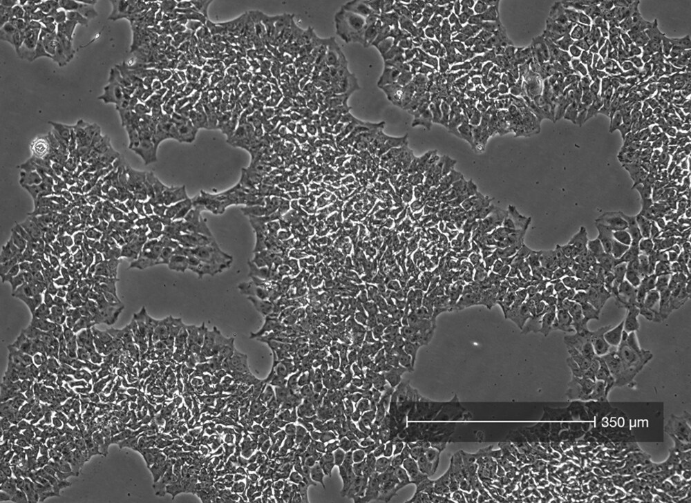 Cell confluency view