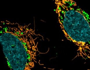 Image on cancer cells