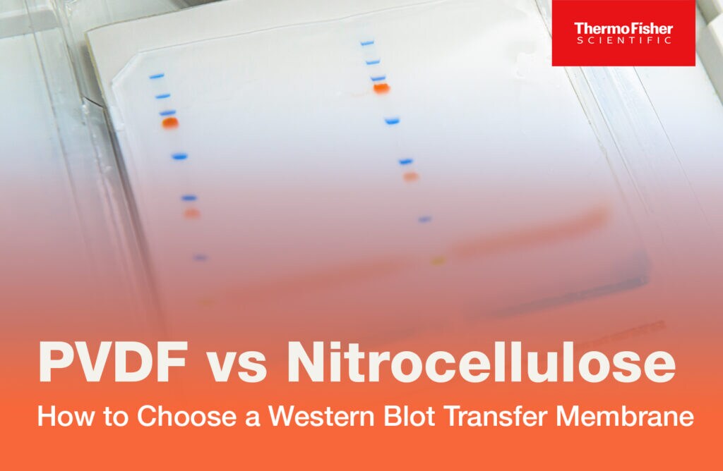PVDF vs Nitrocellulose: How to Choose a Western Blot Transfer Membrane