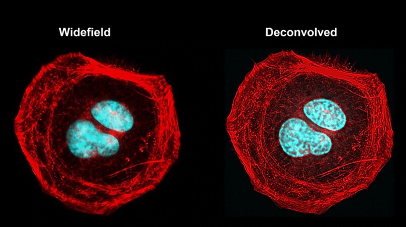 Deconvolution of a widefield HeLa cell image with fluorescent staining shows a much clearer image of cellular structure