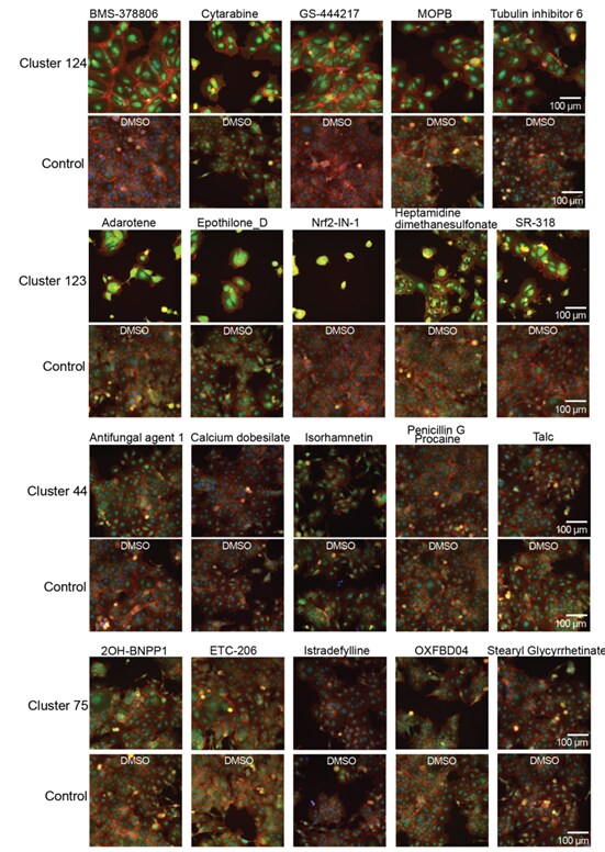 Ovarian cancer cell line response to different drug candidates as showed in fluorescent HCS microscopy