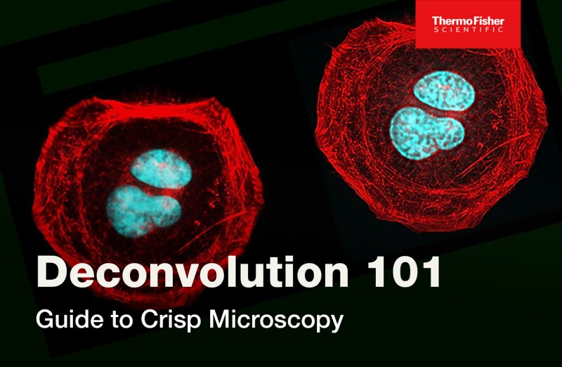 Deconvolution 101: Guide to Crisp Microscopy
