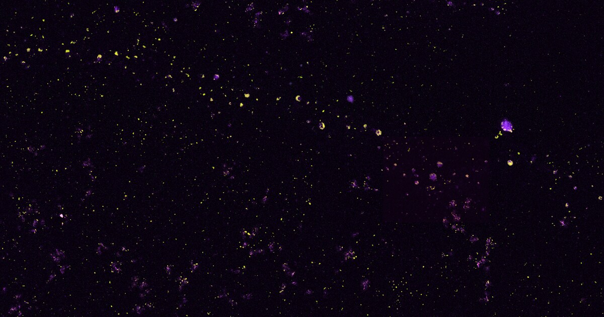 Nanoparticles characterized with automated microscopy