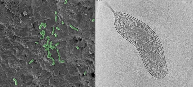 TEM vs SEM image of bacteria TEM vs SEM image of bacteria