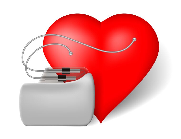 heart pacemaker