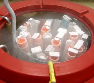 Cryogenic Preservation