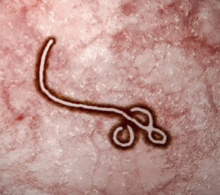 ebola virus