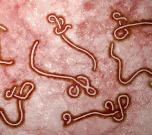 Microscopic view of the ebola virus. Image: Nixx Photography/Shutterstock.com