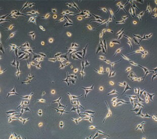 HeLa cervical cancer cells. Image: Loren Rodgers/Shutterstock.com