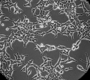 Embryonic kidney cells in culture. Image: Jan Bruder/Shutterstock.com