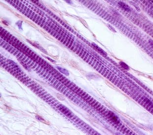 Skeletal muscle. Image: Jose Luis Calvo/Shutterstock.com
