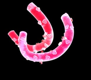 Ebola virus with surface proteins. Image: Bildagentur Zoonar GmbH/Shutterstock.com