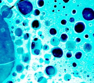 Cancer cells. Image: Shebeko/Shutterstock.com