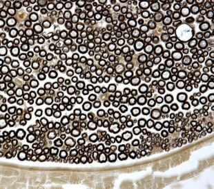 Myelin sheath. Image: Jose Luis Calvo/Shutterstock.com