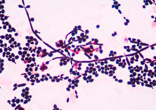 Budding yeast. Image: toeytoey/Shutterstock.com