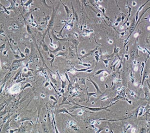 Muscle cells. Image: Paul Hakimata Photography/Shutterstock.com