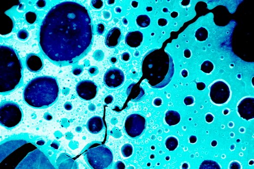 Cancer cells. Image: Shebeko/Shutterstock.com