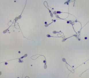 Sperm under a microscope. Image: Carolina K. Smith MD/Shutterstock.com
