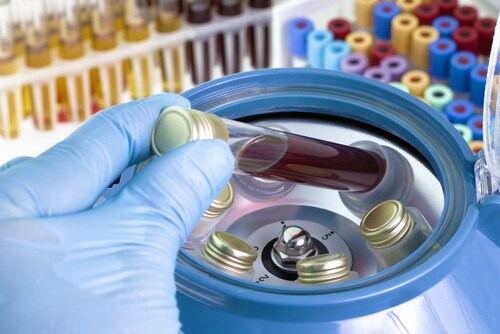 Blood sample in a centrifuge. Image: angellodeco/Shutterstock.com