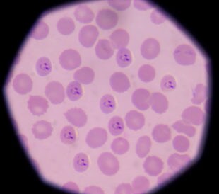 Plasmodium falciparum under a microscope. Image: toeytoey/Shutterstock.com