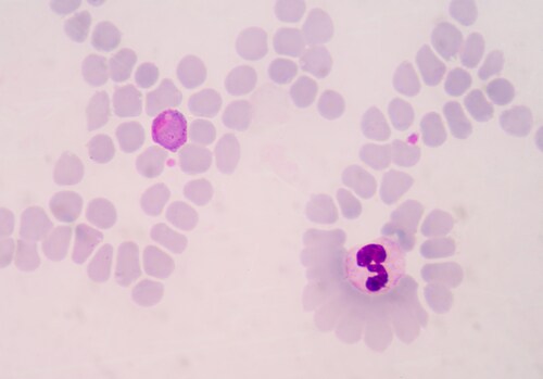 Blood films for malaria parasite. Image: toeytoey/Shutterstock.com
