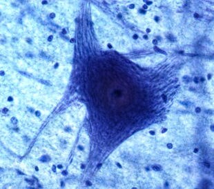 Neurons and glia at 60x. Image: Christopher Meade/Shutterstock.om
