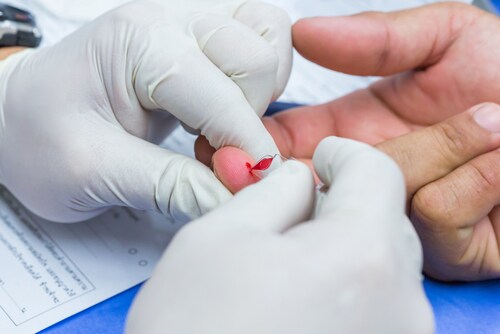 Researcher taking a finger prick blood sample. Image: Smith1972/Shutterstock.com
